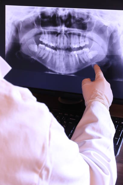 Best Pediatric Emergency Dentist in East Foothills, CA